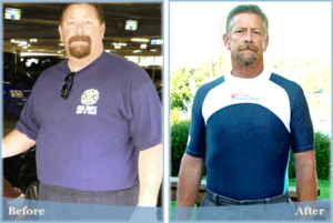 Before And After Weight Loss