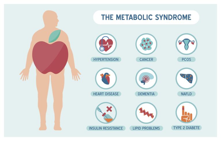 Understanding Metabolic Syndrome: A Growing Health Concern